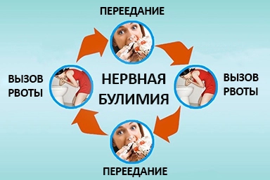 Лечение булимии в Богородицке